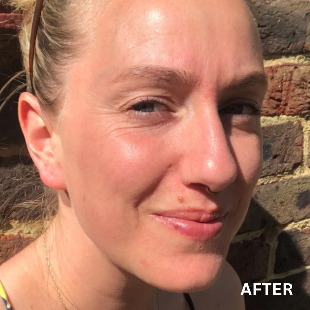 The Established + Clean Slate Bundle | Natural Skincare For Combination Skin | Dry & Oily Skin type