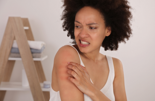 Woman Itching Winter Eczema Irritated Skin