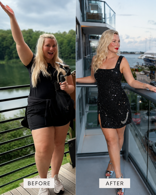 Are we being bullied into wanting to be thin again? Weight-loss injections, food noise and diet culture