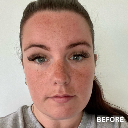 The Balance + Clean Slate Bundle | Natural Skincare for Uneven Skin Tone & Hyperpigmentation