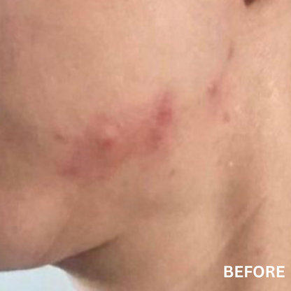 The Lustrous | Natural Skincare for Oily & Acne-Prone Skin