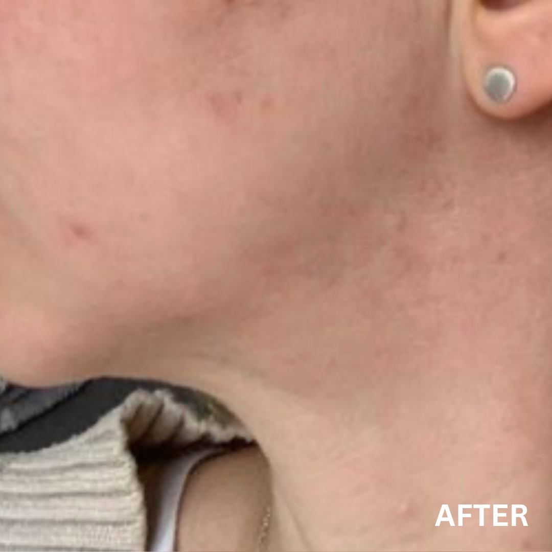 The Lustrous | Natural Skincare for Oily & Acne-Prone Skin