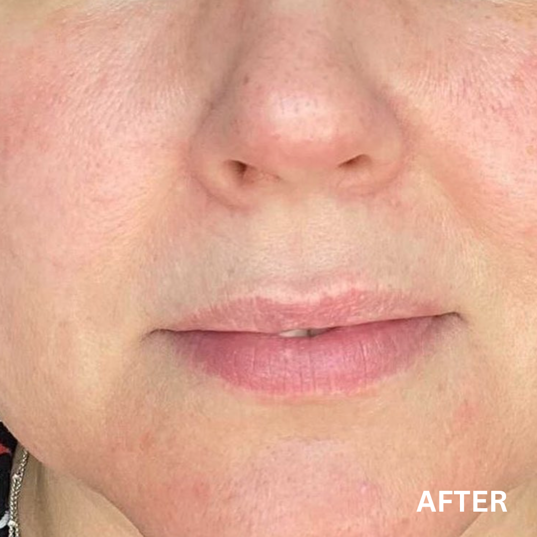The Balance + Clean Slate Bundle | Natural Skincare for Uneven Skin Tone & Hyperpigmentation