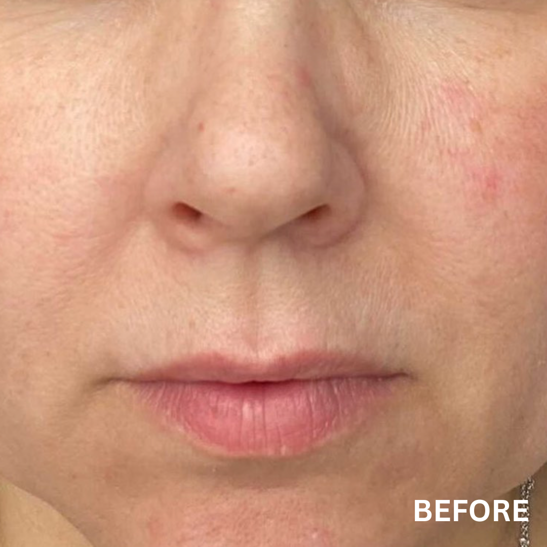 The Balance + Clean Slate Bundle | Natural Skincare for Uneven Skin Tone & Hyperpigmentation