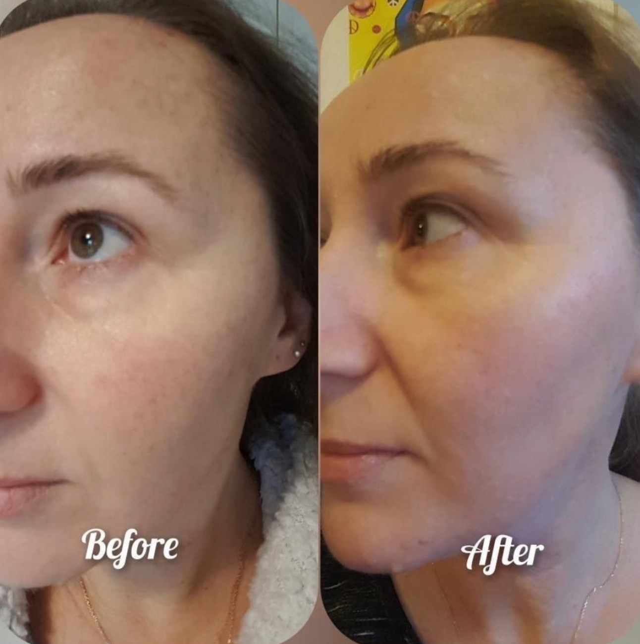 The Balance + Clean Slate Bundle | Natural Skincare for Uneven Skin Tone & Hyperpigmentation